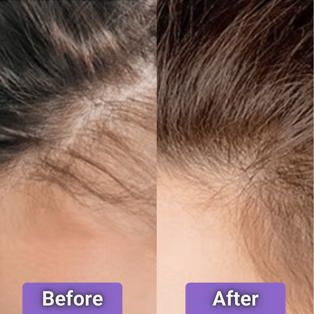 Numoya - 4-in-1 Growth Brush - NUMOYA